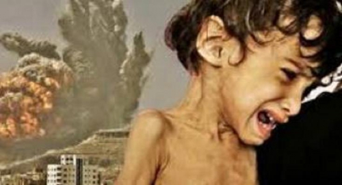 2. yemen-suffering-war-crrimes[1].jpg